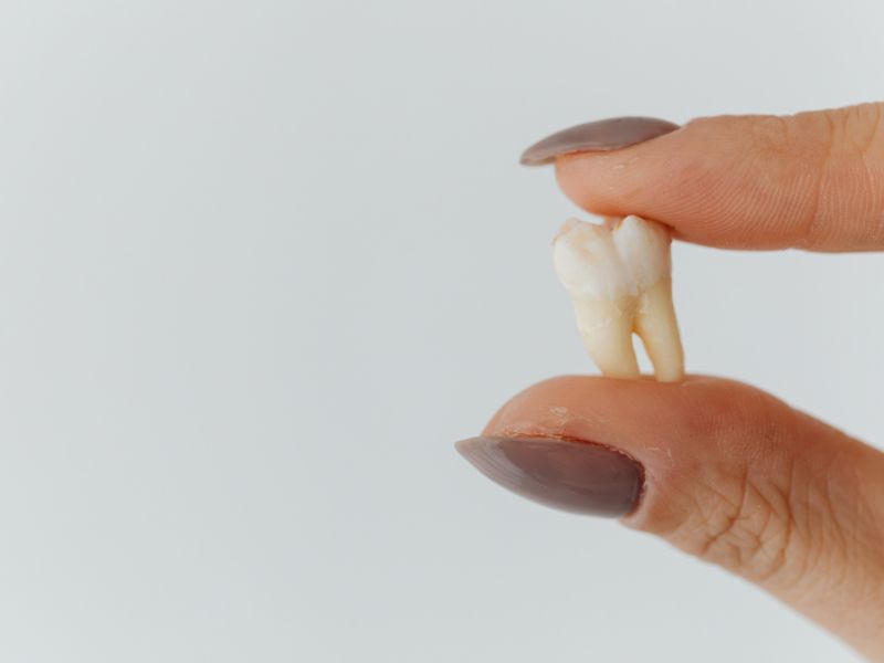 Šta znači sanjati ljudski zub?
